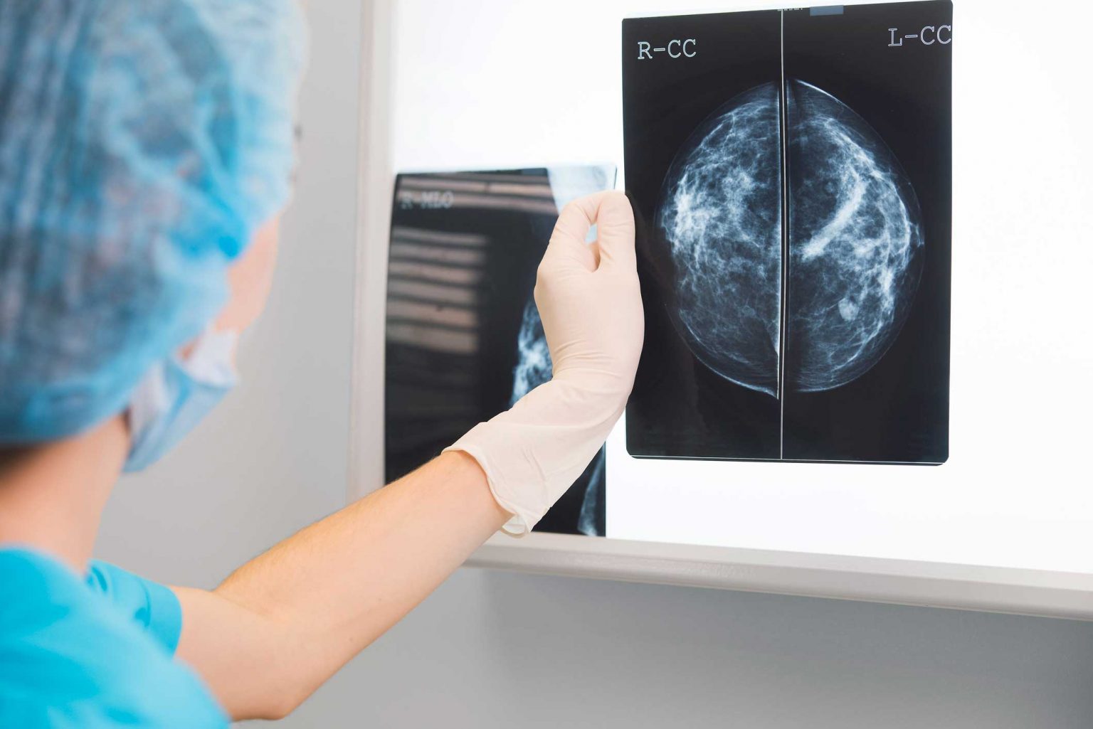 doctor reading a mammogram